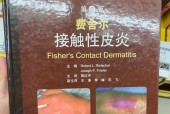 接触性皮炎的症状有哪些？医院计划如何详细介绍？
