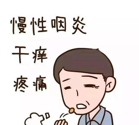 喉炎的症状有哪些？医院计划喉炎的详细症状介绍是什么？  第1张
